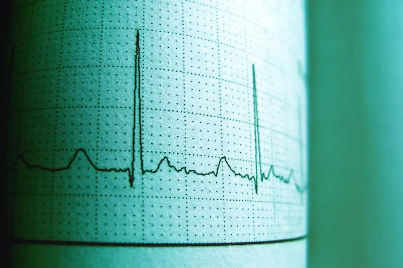 La frecuencia cardíaca como indicador de la salud